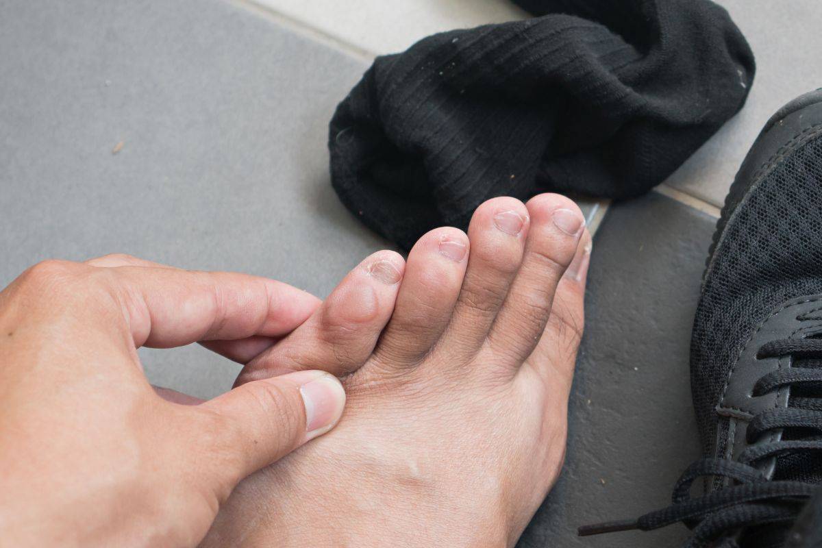 How running shoes should fit